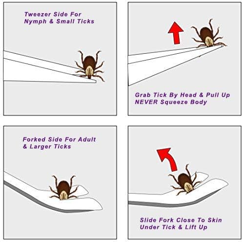 eTradewinds Tick Remover Tool | Tick-Off Pro | Hygienic All Stainless Steel Tick Removal Tool with Leather Case (4-Pack)