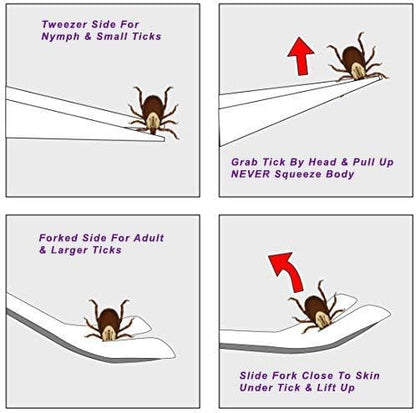 eTradewinds Tick Remover Tool | Tick-Off Pro | Hygienic All Stainless Steel Tick Removal Tool with Leather Case (4-Pack)