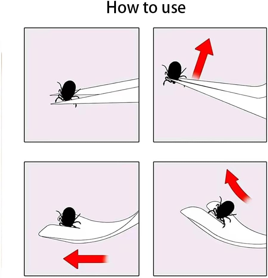 1 Pc Silver 2 in 1 Tick Removal Tool for Pets, Stainless Steel Tick Remover Tools, Professional Tick Tweezers Ticks Remover for Dogs, Cats and Humans, Flea and Tick Control