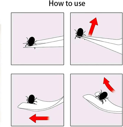 1 Pc Silver 2 in 1 Tick Removal Tool for Pets, Stainless Steel Tick Remover Tools, Professional Tick Tweezers Ticks Remover for Dogs, Cats and Humans, Flea and Tick Control