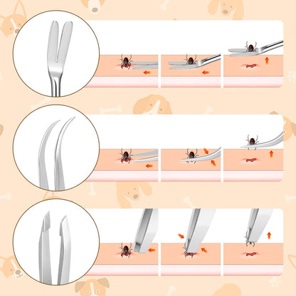 Rypet Tick Remover Tool Set - Stainless Steel Tick Remover Kit for Cats Dogs and Humans(Pack of 3)