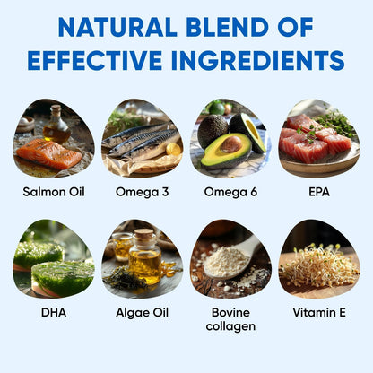 Omega 3 Fish Oil for Dogs Chews - Dog Skin & Coat Supplement for Itch Relief, Hot Spot Treatment - USA Product - Salmon Oil for Dogs Itching Skin Relief, Shedding, Hip & Joint Health - 120 Soft Treats