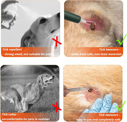 Premium Tick Remover Kit for Dogs and Humans - 54 in 1 Hiking Essentials with First Aid Case, Stainless Steel Tick Remover + Tweezers, Tick Remover Tools for Dogs Cats Pet Tick Comb