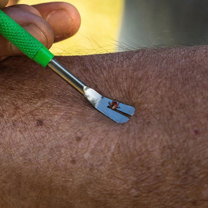 TickCheck Premium Tick Remover Kit - Stainless Steel Tick Remover + Tweezers, Leather Case, and Free Pocket Tick Identification Card (1)