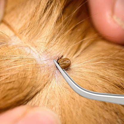 Rypet Tick Remover Tool Set - Stainless Steel Tick Remover Kit for Cats Dogs and Humans(Pack of 3)