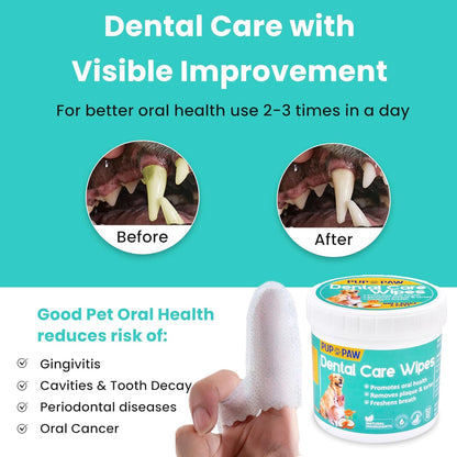 Premium Dog Teeth Cleaning Wipes - All Natural dog Toothbrush & Tooth Brushing Kit - Pet Dental Finger Wipes for cats & dogs - Freshens Breath, Reduces Tartar & Plaque - All in one finger wipes (50)