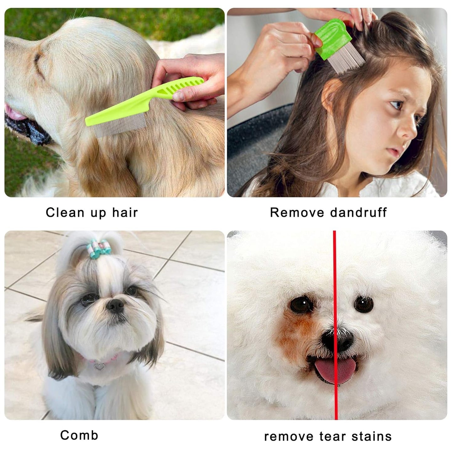 Lamoutor 7Pcs Pet Flea Comb Fine Tooth Comb and Pet Stainless Steel Combs for Dogs Cats Pet