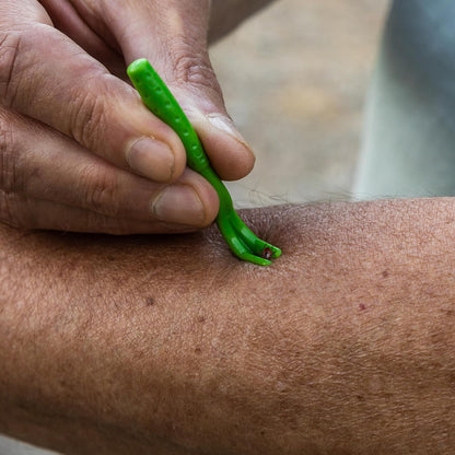 TickCheck Tick Remover Value 3 Pack - Tick Remover Tools + Tick Identification Card - for Humans, Dogs & Cats (5)